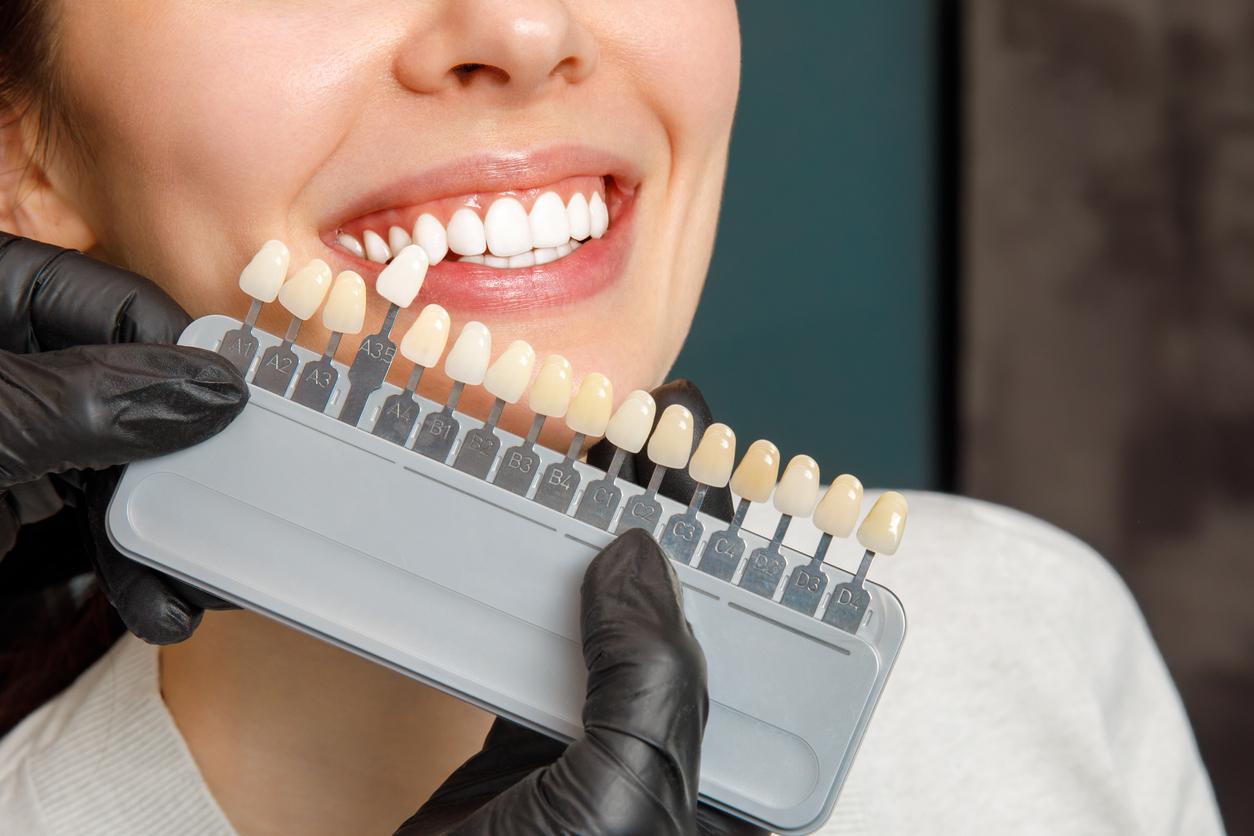Dental veneer color options being held up to a woman's smile.